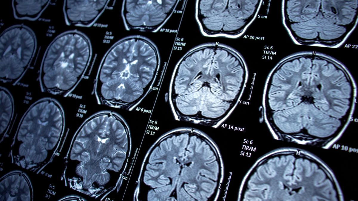 Celebrities are turning to MRI scans to help predict future illnesses. Should the rest of us? 